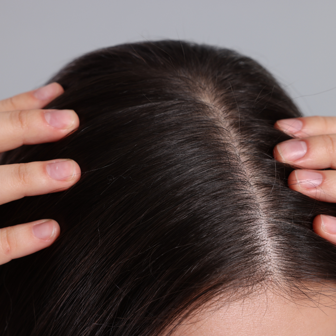 Shampoo Anticaída GRR + Serum Anticaída GRR